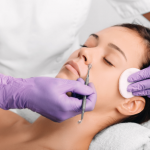  LIMPIEZA FACIAL 