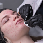 LIMPIEZA FACIAL PROFUNDA